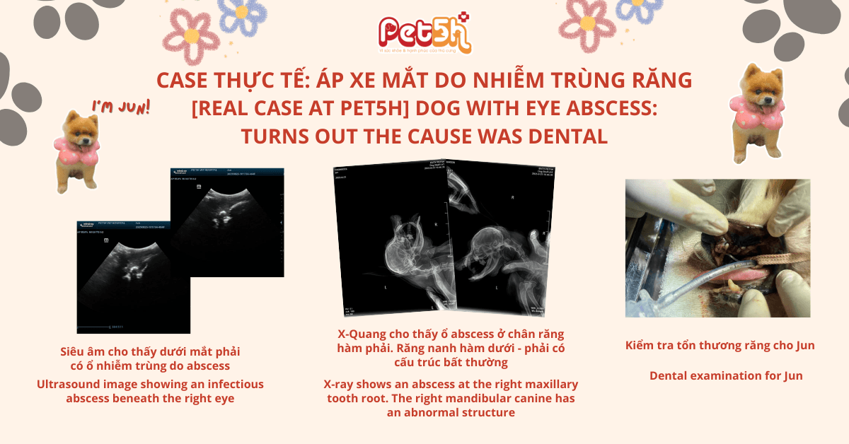 áp xe mắt